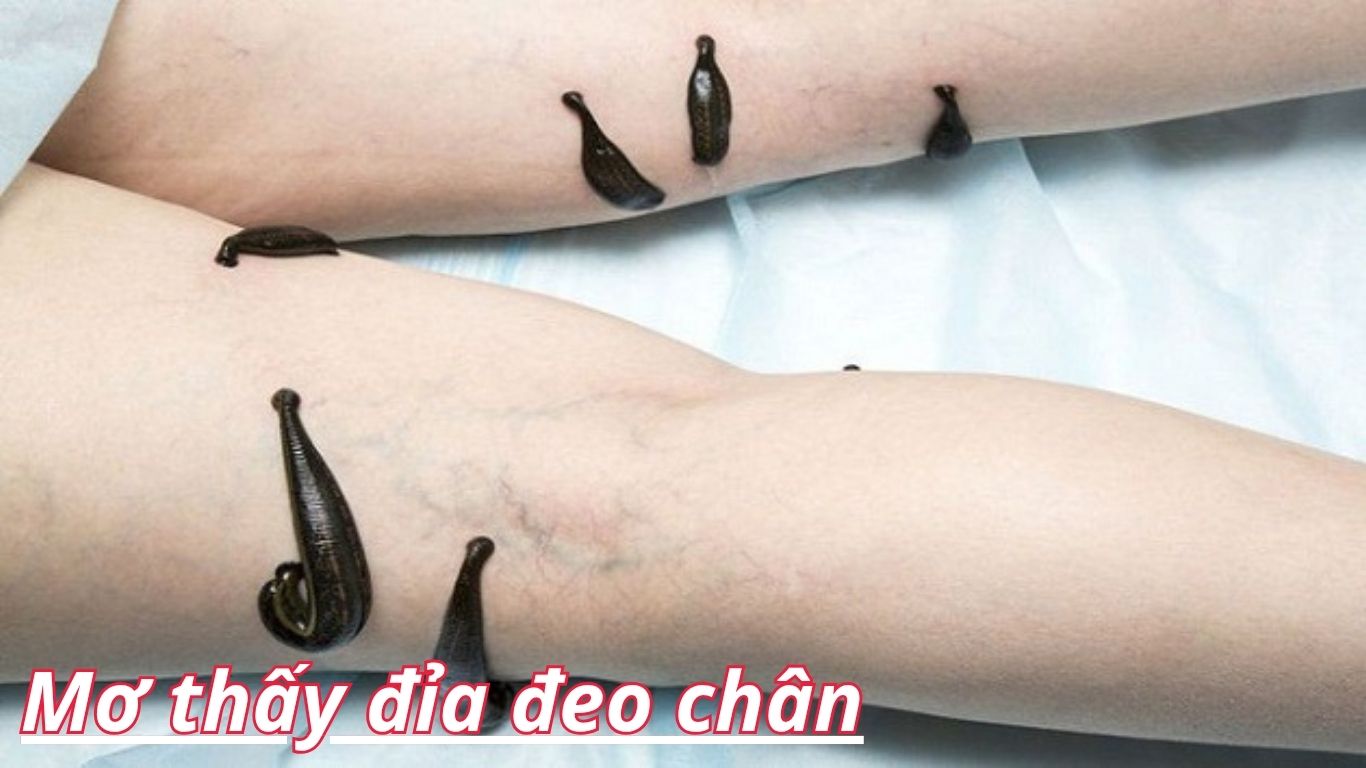 Điềm báo giấc mơ thấy đỉa tốt hay xấu?